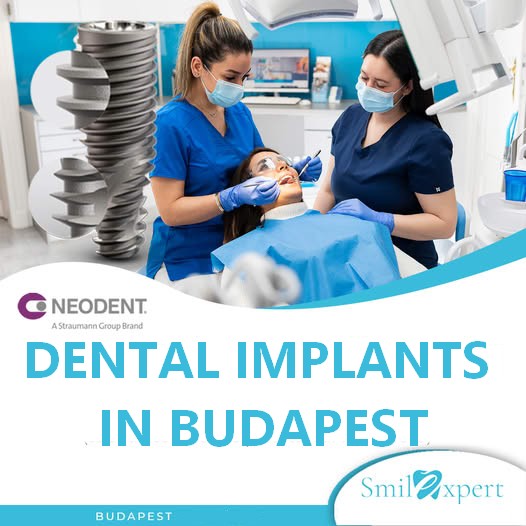 Dental implants in Budapest